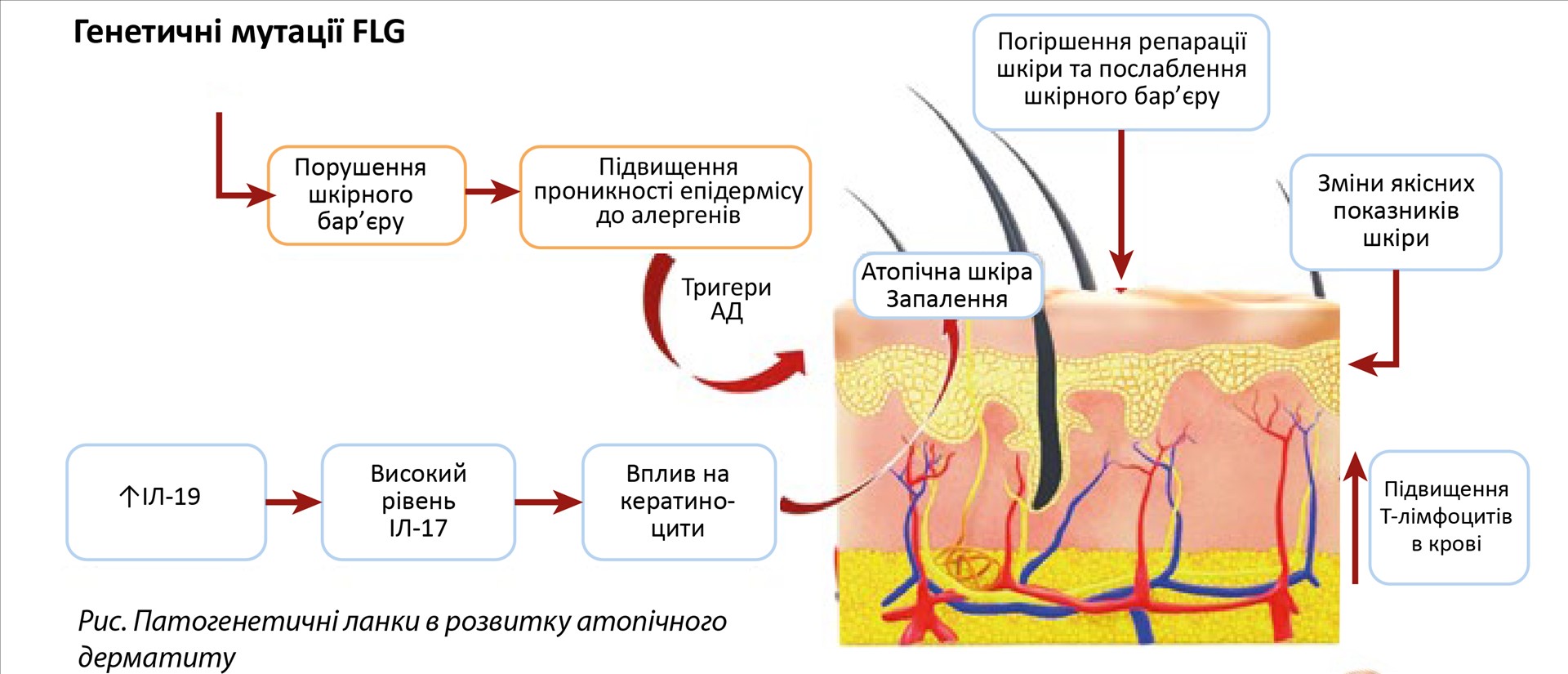 ЕЛІДЕЛ® – лікування та контроль атопічного дерматиту можливі вже з трьох місяців!