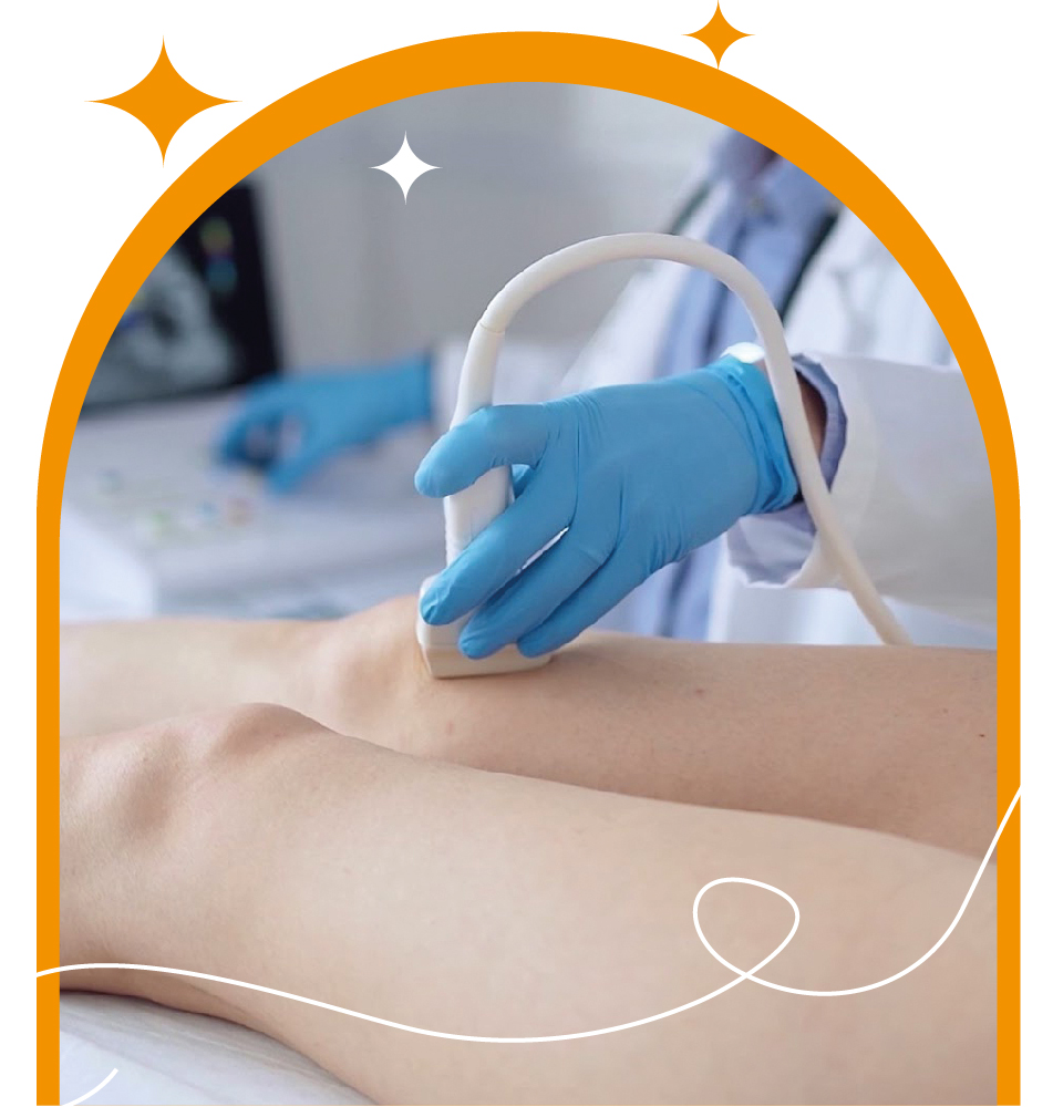 Синдром «втомлених ніг» місце ЕСКУЗАН® краплі у терапії венозних порушень