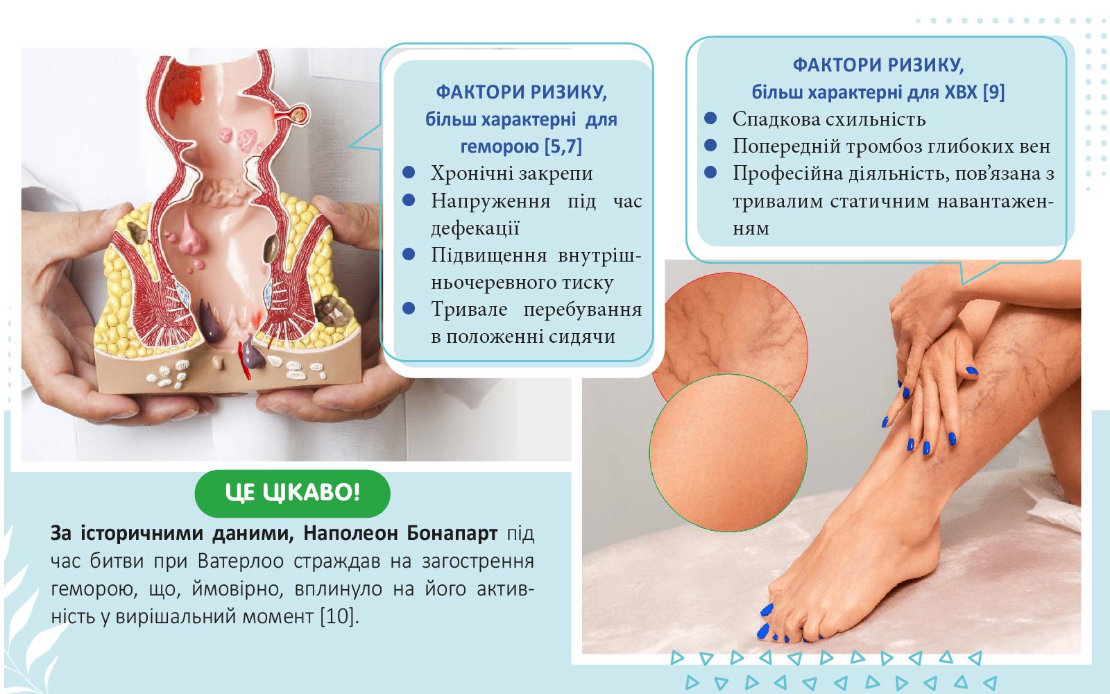 НОРМОВЕН 1000 — доказове рішення при важкості в ногах і геморої