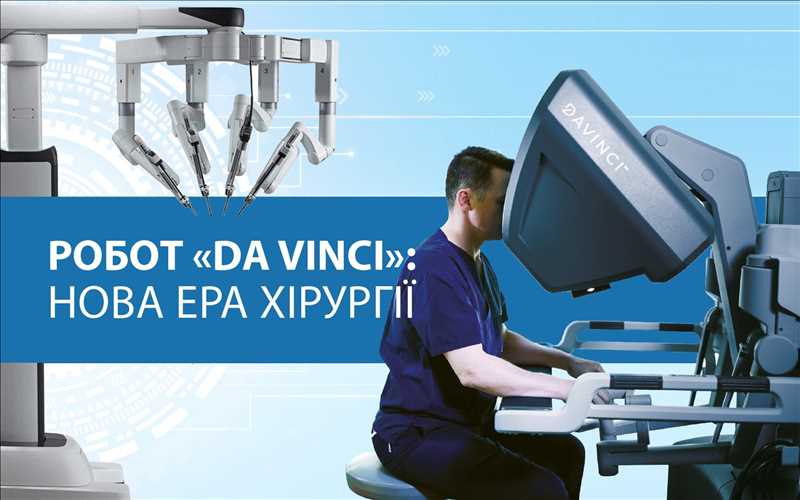 Робот «DA VINCI»: нова ера хірургії