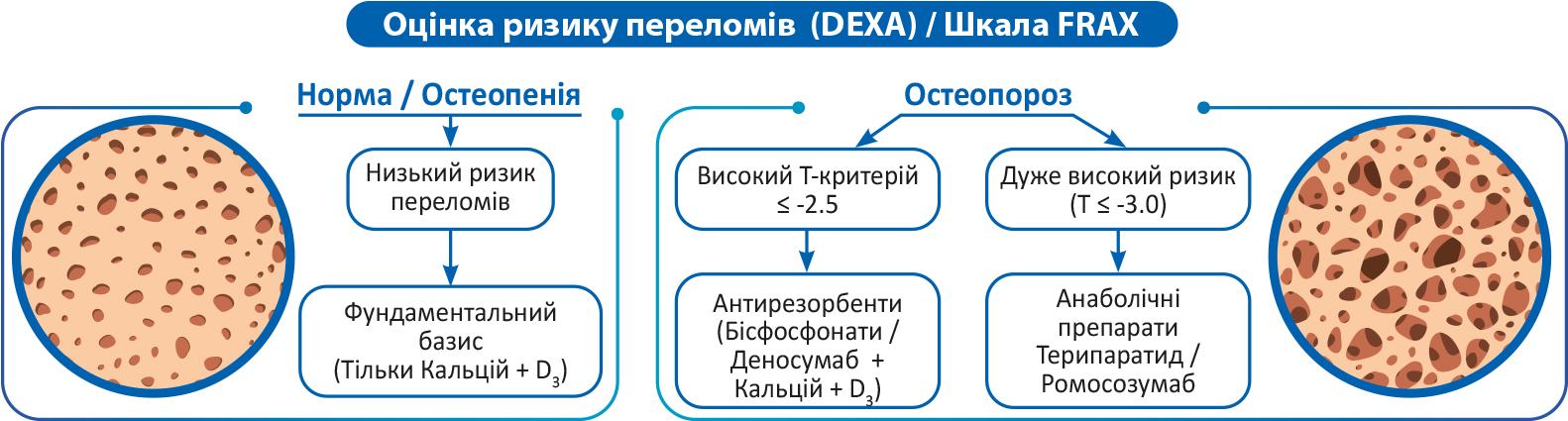 Сучасні вектори фармакотерапії остеопорозу